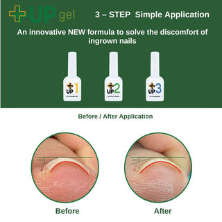 Up Gel Set