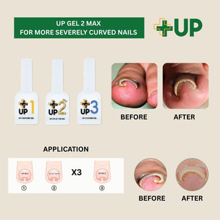 Up Gel Set